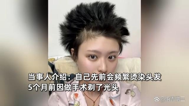 快速科普一下！女生剃光头蓄发5个月炸毛似海胆,百科词条撰词_2024新网