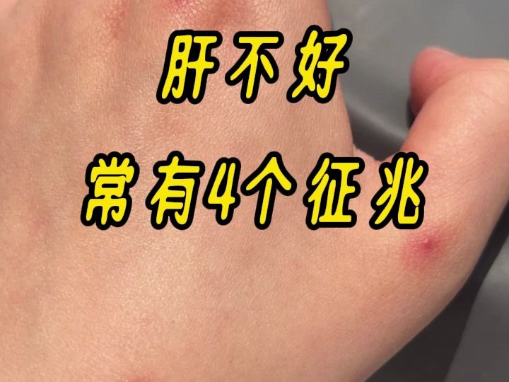 快速科普一下！肝不好有什么症状,百科词条撰词_2024新网